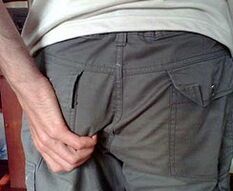 Como recoñecer a presenza de parasitos no corpo