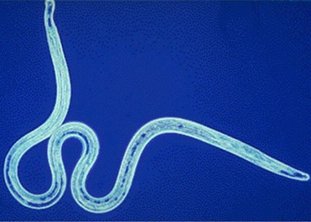 nematodos no corpo humano
