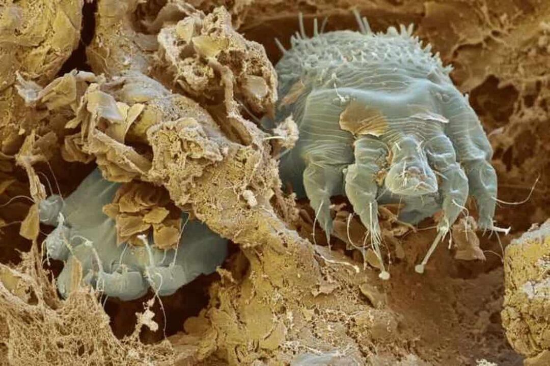 ácaro da sarna ao microscopio